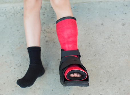 Lower Limb Orthotics  Knee, Ankle, Foot, Hip Abduction